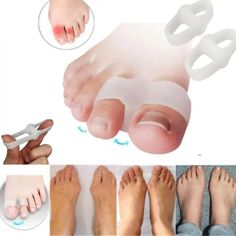 Correction Fluid White - 2-Loch-Bunion-Korrektor, Schmerzlinderung, Zehenspreizer, Gel-Glätteisen für überlappende